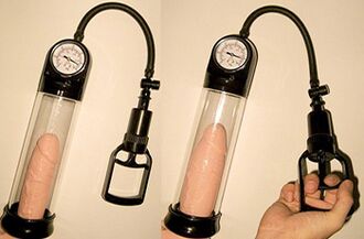 Penis enlargement of 3-4 cm in length in 1 day using a vacuum pump