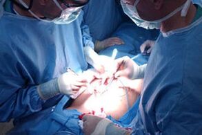 Perform an operation to increase the penis