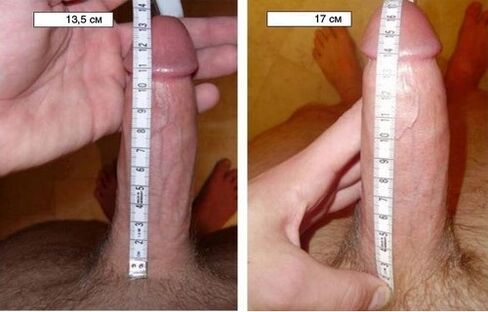 penis before and after enlargement with the pump
